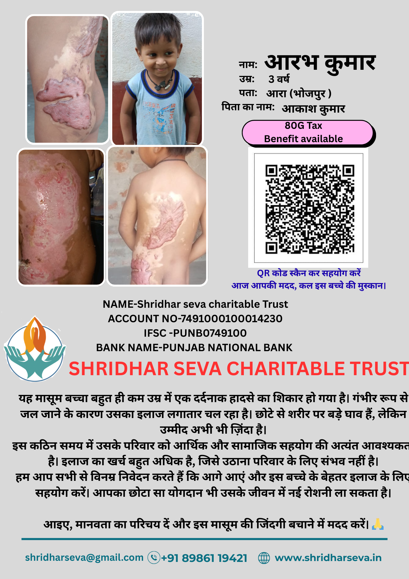 Help Aarav Recover from Severe Burn Injuries